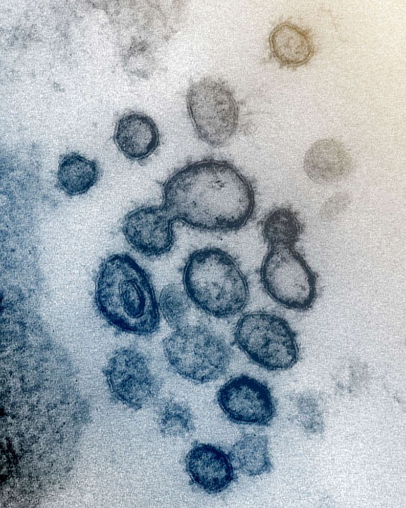 PHOTO: An undated transmission electron microscope image shows SARS-CoV-2, also known as novel coronavirus that causes COVID-19, isolated from a patient in the U.S. Virus particles are shown emerging from the surface of cells cultured in the lab.