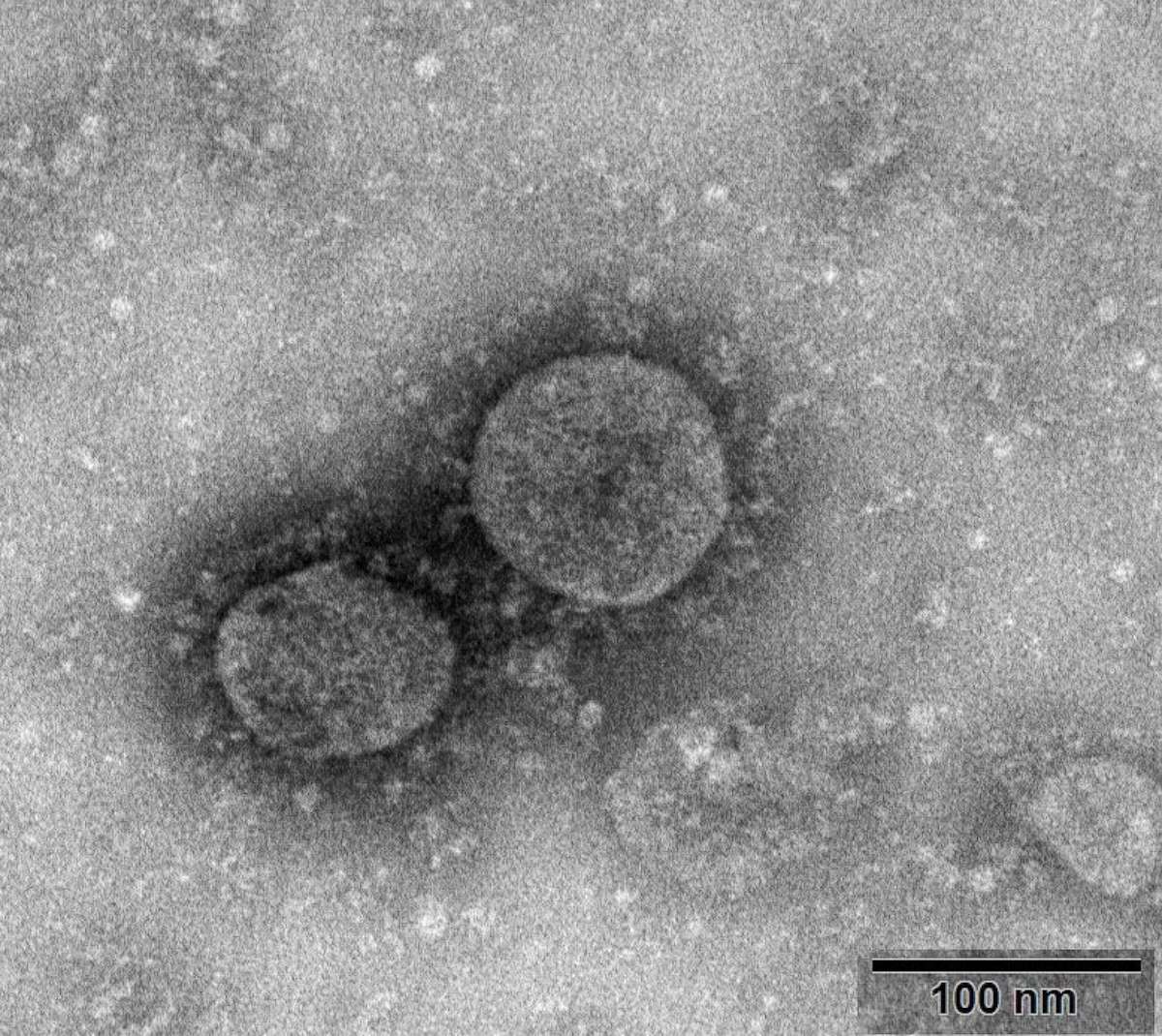 PHOTO: Handout from the National Institute for Viral Disease Control and Prevention, China CDC, on Jan. 27, 2020, shows an image of the first new type of coronavirus isolated from environmental samples, named C-F13-nCoV Wuhan strain 02.