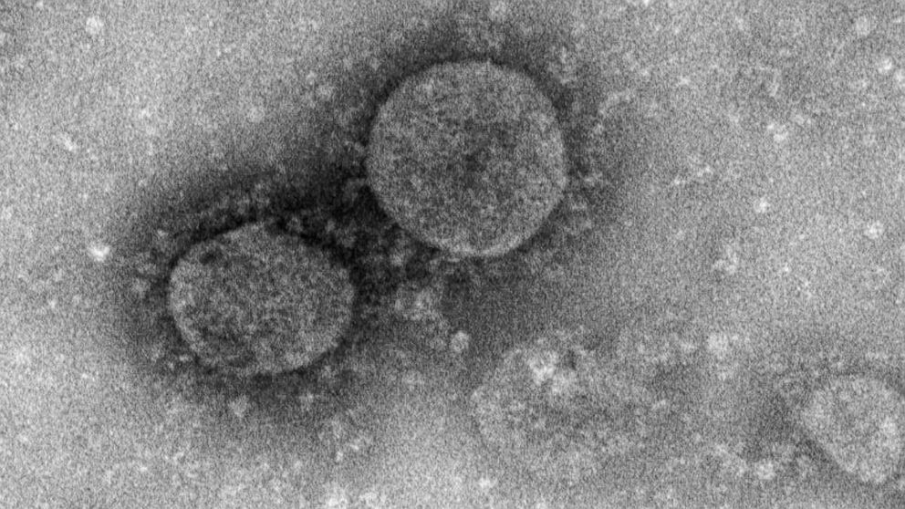 PHOTO: Handout from the National Institute for Viral Disease Control and Prevention, China CDC, on Jan. 27, 2020, shows an image of the first new type of coronavirus isolated from environmental samples, named C-F13-nCoV Wuhan strain 02.