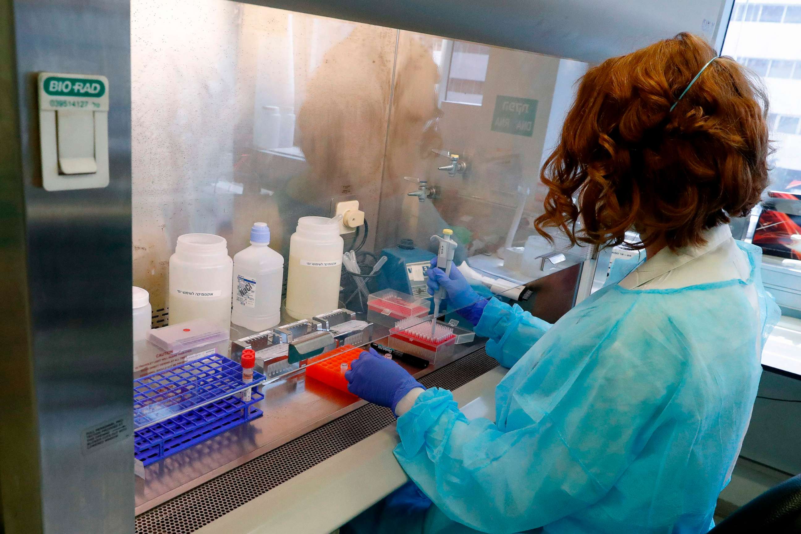 PHOTO: Israeli scientist Katya Levitski conducts tests on the coronavirus at the Tel Aviv Sourasky Medical Center, Israel's leading multidisciplinary healthcare institution, on March 19, 2020 in Tel Aviv.