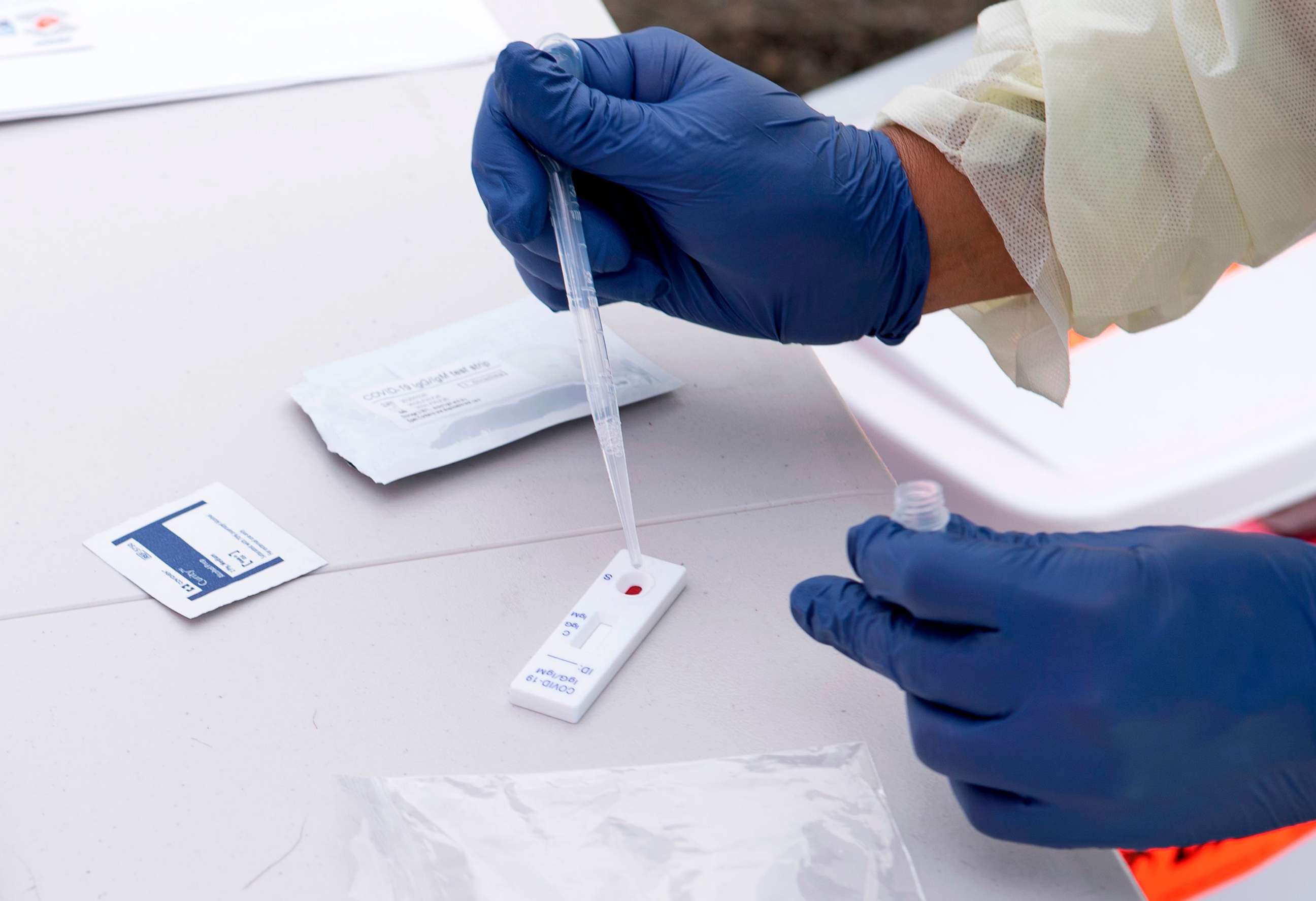 PHOTO: A health worker process for COVID-19 antibodies  after getting the blood from the patient at the the Diagnostic and Wellness Center, May 5, 2020, in Torrance, Calif.