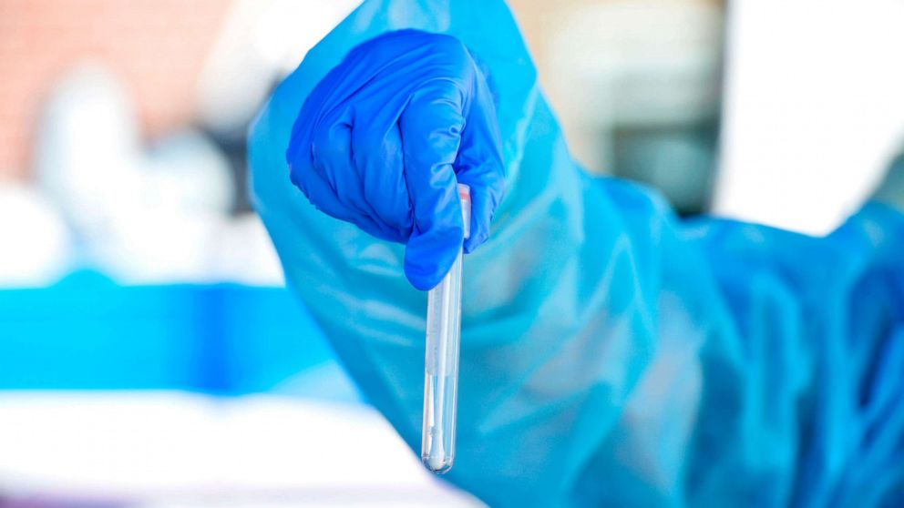 PHOTO: A health worker holds up a test tube with a Covid-19 test sample taken from a person at Revere Beach in Revere, Massachusetts, Aug. 11, 2020.