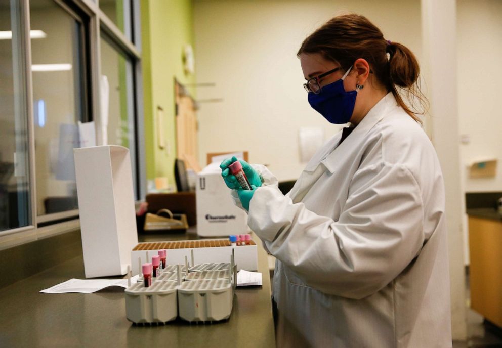 PHOTO: Jacqueline Dunlap prepares whole blood samples for placement into a centrifuge to separate plasma for antibody testing at the Bloodworks Northwest Laboratory during the coronavirus disease (COVID-19) outbreak in Renton, Washington, Sept. 9, 2020.