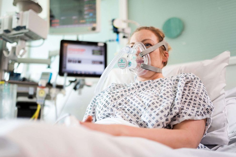 PHOTO: A volunteer patient poses wearing the Continuous Positive Airway Pressure (CPAP) breathing aid, developed in less than a week by mechanical engineers, doctors and the Mercedes Formula 1 team in conjunction with University College London (UCL). 