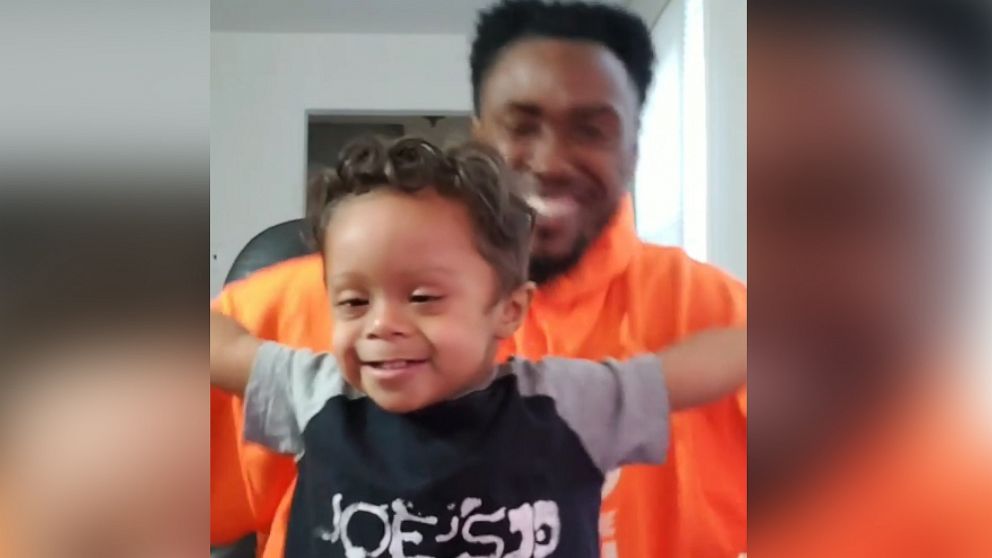 VIDEO: Toddler dances with dad to celebrate being cancer-free in style