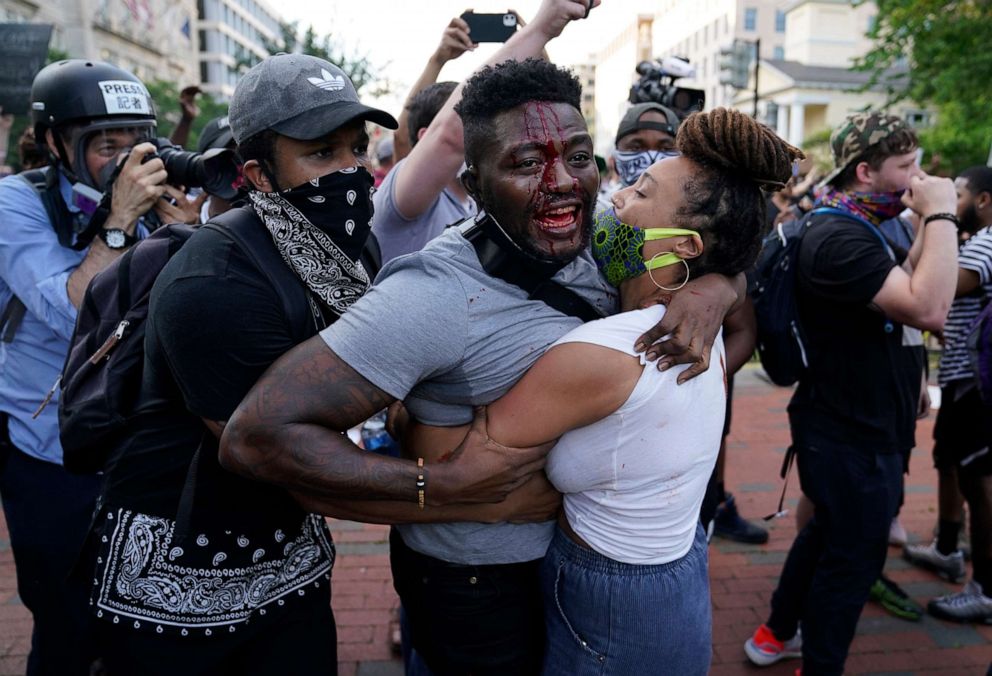 PHOTO: A demonstrator is injured as people protest the death of George Floyd, May 30, 2020, near the White House in Washington, D.C.