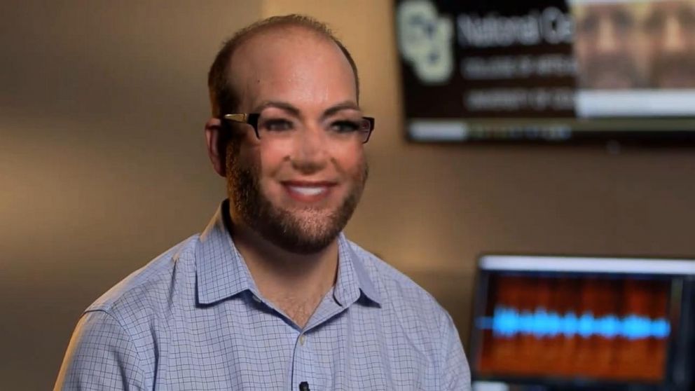 PHOTO: Jeff Smith at the University of Colorado Denver walked ABC News' Kyra Phillips through the process of face swapping -- giving it a try.