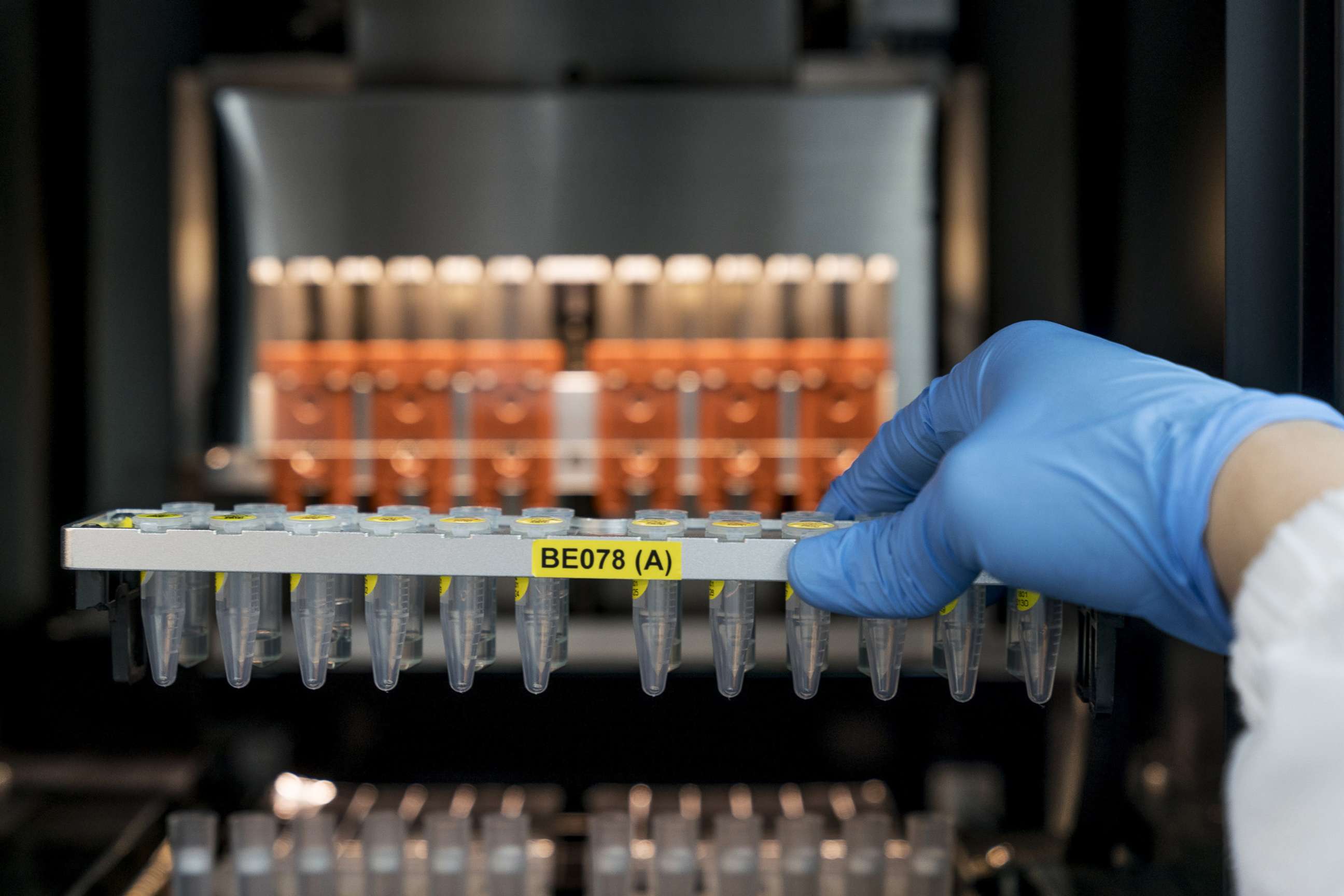 PHOTO: A technician handles samples at a Prenetics Inc. laboratory in Hong Kong, China, on Friday, Jan. 26, 2018.