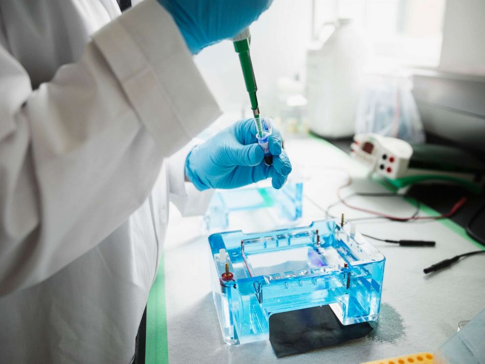 PHOTO: A scientist with pipette loading DNA gels in a laboratory.