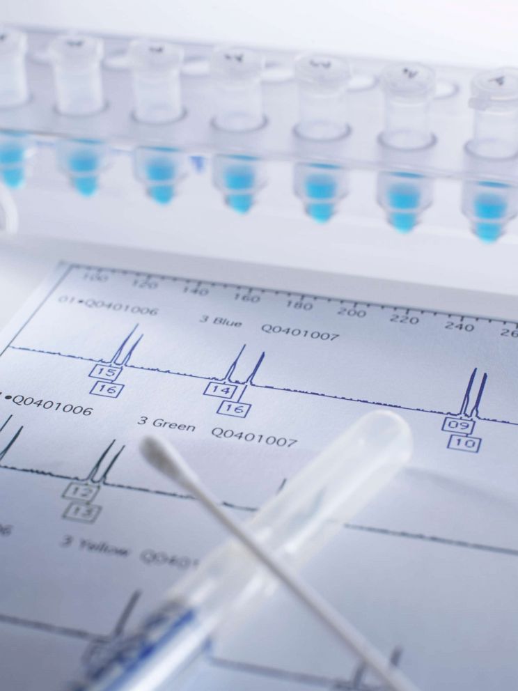 PHOTO: Samples and a swab containing DNA sample on genetic testing results.