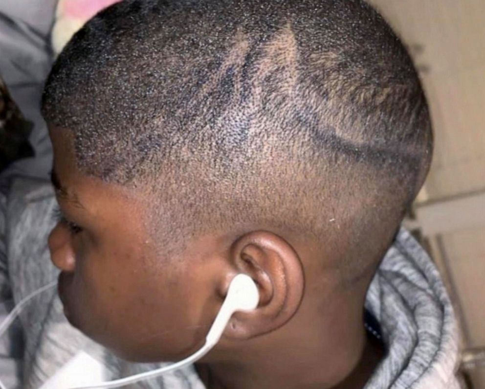 PHOTO: A school administrator is on leave after using a marker to draw on seventh-grader Juelz Trice's head.