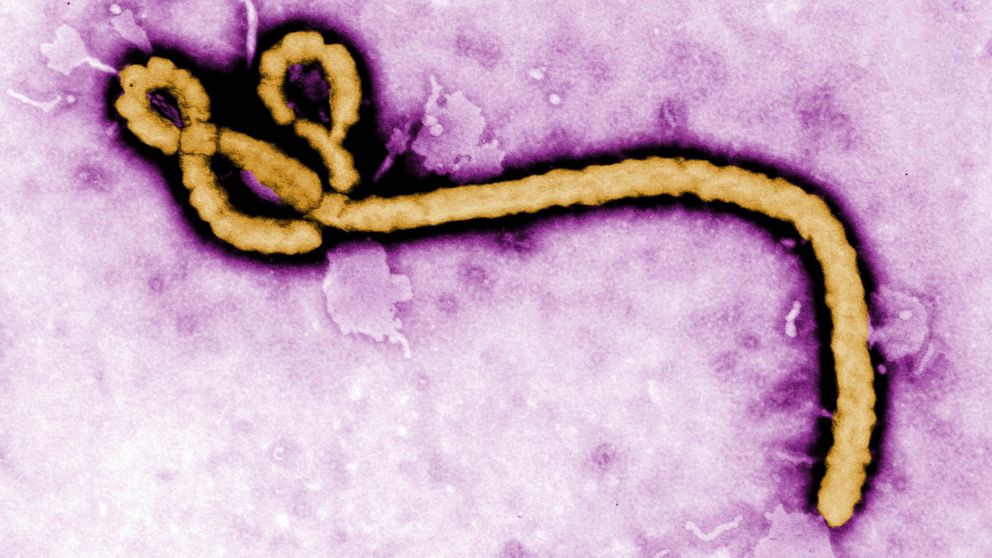 An Ebola virus virion is pictured in this undated colorized transmission electron micrograph file image made available by the CDC.