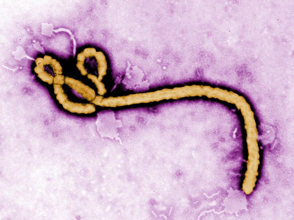   PHOTO: An Ebola virus virion is described in this undifferentiated colorized electronic micrograph file file made available by the CDC. 