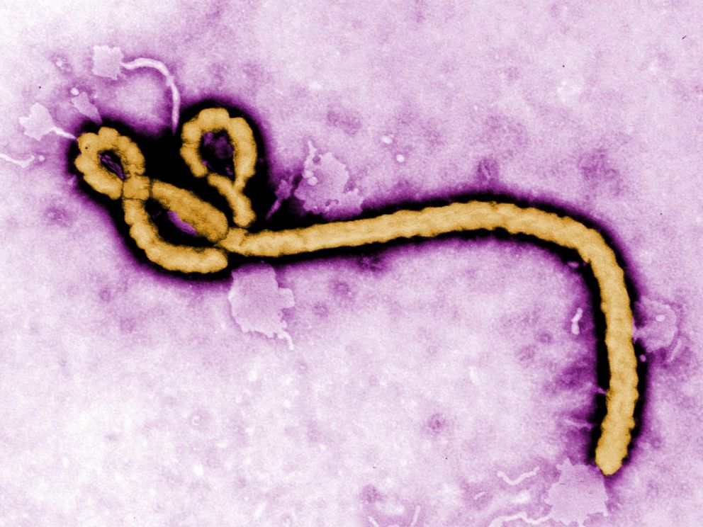 PHOTO: An Ebola virus virion is pictured in this undated colorized transmission electron micrograph file image made available by the CDC.