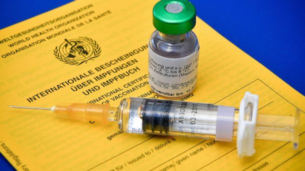 How can those vaccinated still get measles? Although effective, it's no  sure thing – Orange County Register