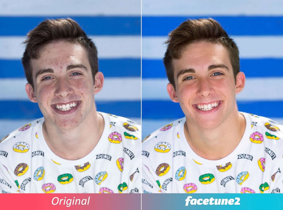 PHOTO: Users use the wildly popular Facetune app to edit away perceived imperfections on their photos. 