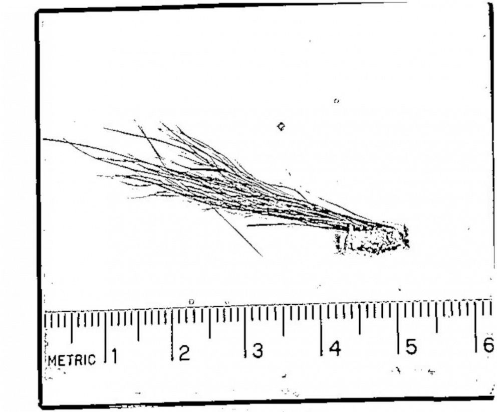 PHOTO: An image released by the FBI on June 5, 2019, shows a hair and tissue sample sent to the FBI Laboratory in the 1970s for testing as part of an investigation into the existence of Bigfoot.
