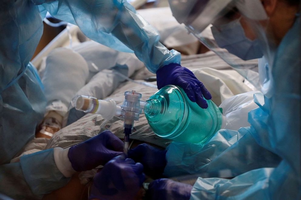 PHOTO: Critical care workers insert an endotracheal tube into a coronavirus disease positive patient in the intensive care unit at Sarasota Memorial Hospital in Sarasota, Fla., Feb. 11, 2021.