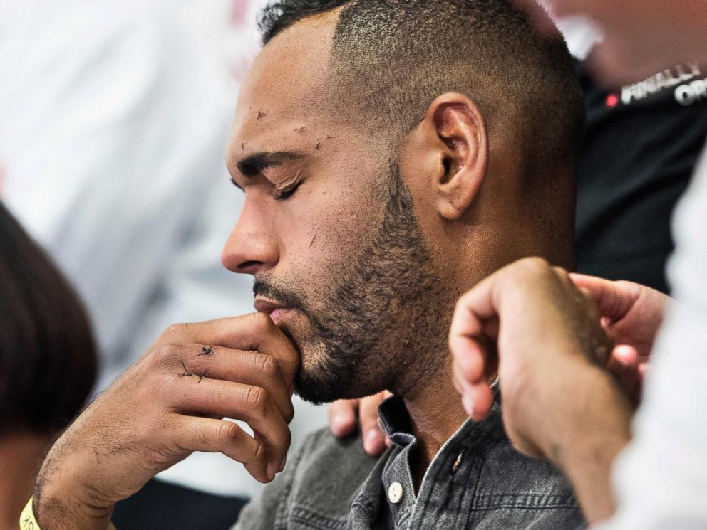 PHOTO: Angel Colon, a survivor of the Pulse nightclub mass shooting, listens during a press conference with Orlando Health trauma staff at Orlando Regional Medical Center, June 14, 2016 in Orlando, Florida.