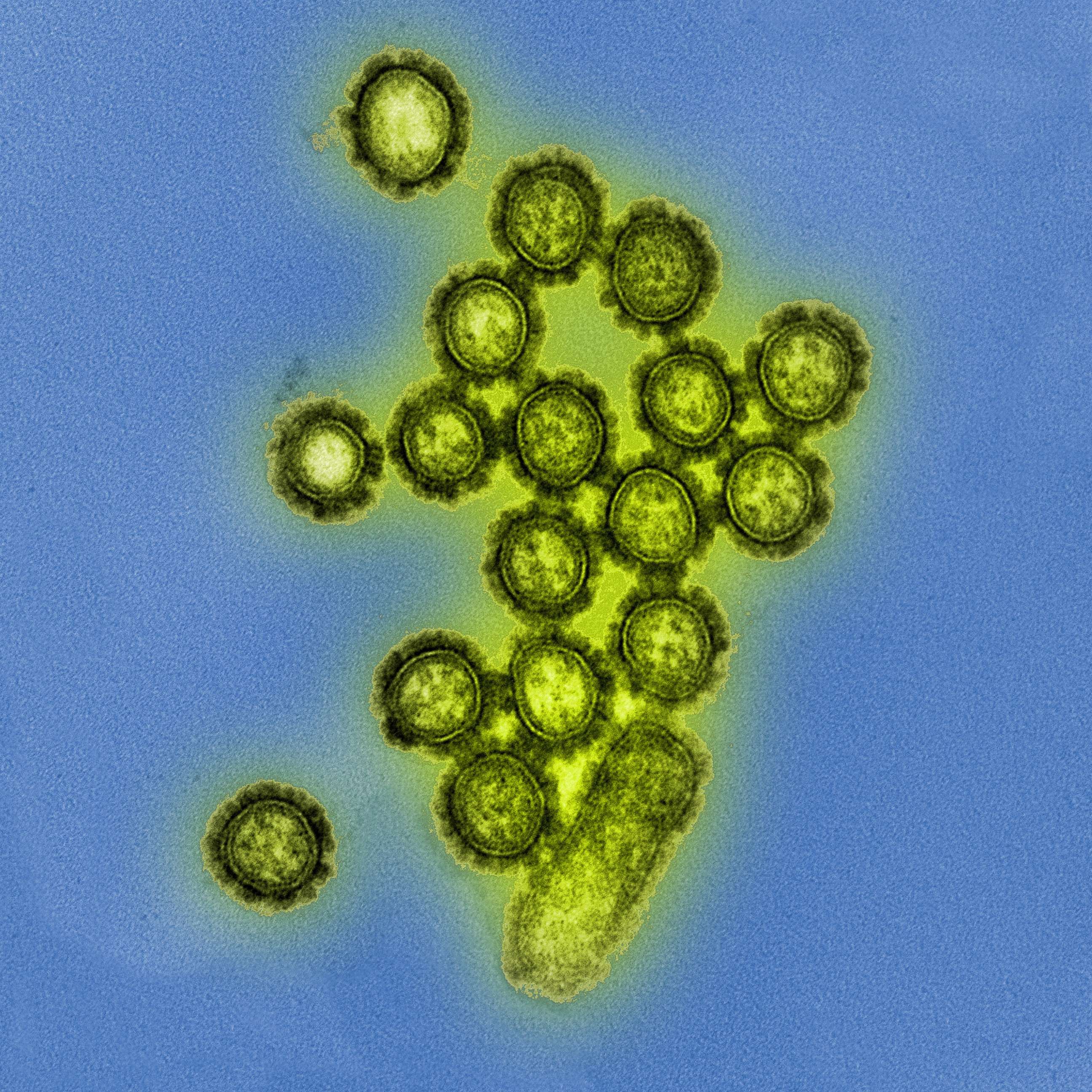 PHOTO: This photo from the National Institute of Health shows H1N1 virus particles. 