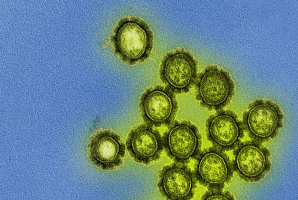 PHOTO: This photo from the National Institute of Health shows H1N1 virus particles. 