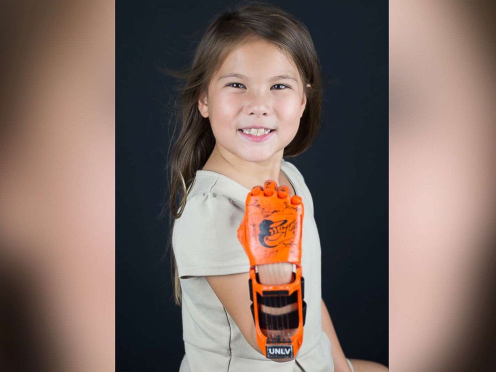 PHOTO: Hailey Dawson, a 7-year-old from Nevada, has thrown the first pitch with her 3-D printed hand for two major league baseball teams and hopes to reach her goal of 28 more.