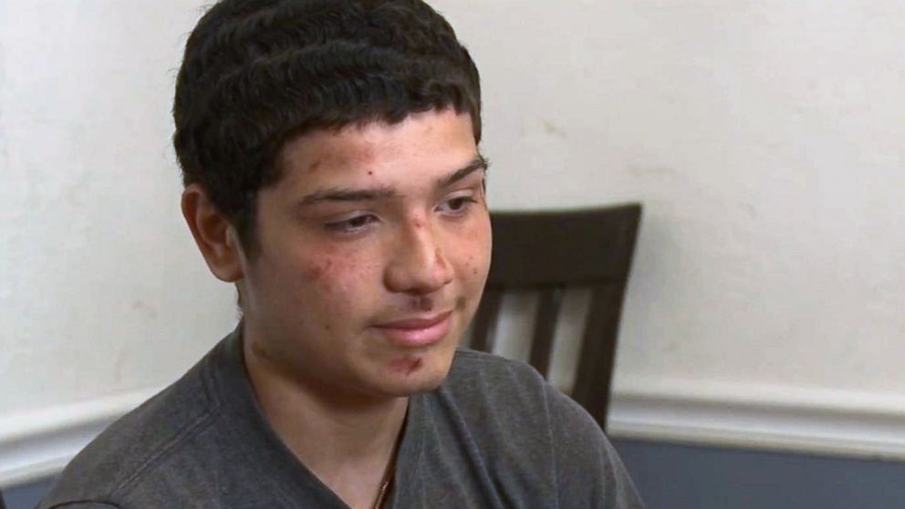 PHOTO: Dominic Garibay, 15, speaks to ABC Chicago station WLS-TV about an altercation with Indiana police officers during a festival.