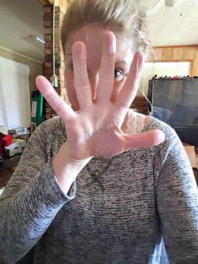 PHOTO: Harmony marks five days of sobriety.