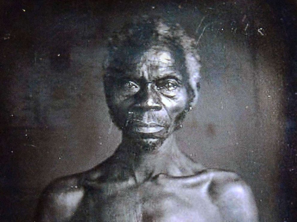 PHOTO: This July 17, 2018 copy photo shows a 1850 Daguerreotype of Renty, a South Carolina slave who Tamara Lanier, of Norwich, Conn., said is her familys patriarch.