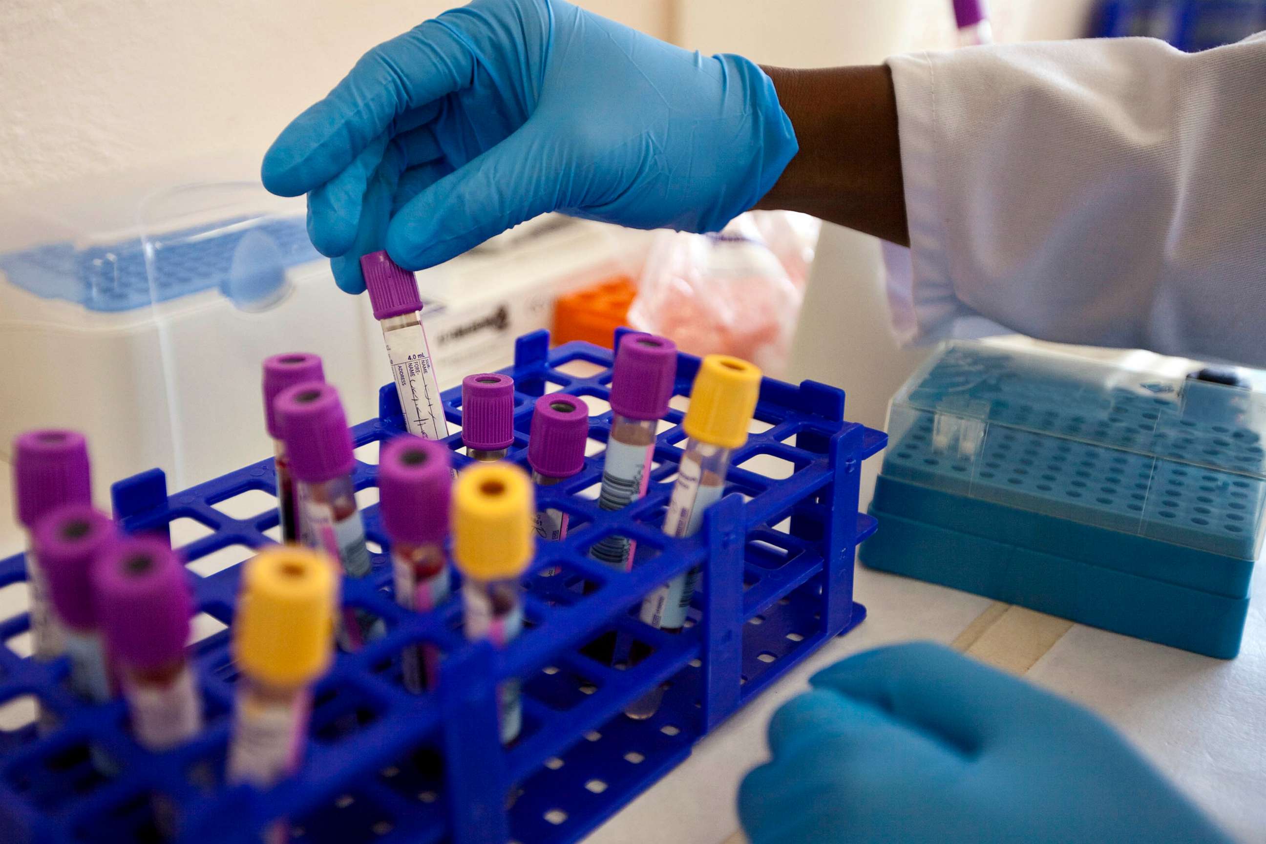 PHOTO: STOCK PHOTO - Blood samples are seen in a lab.