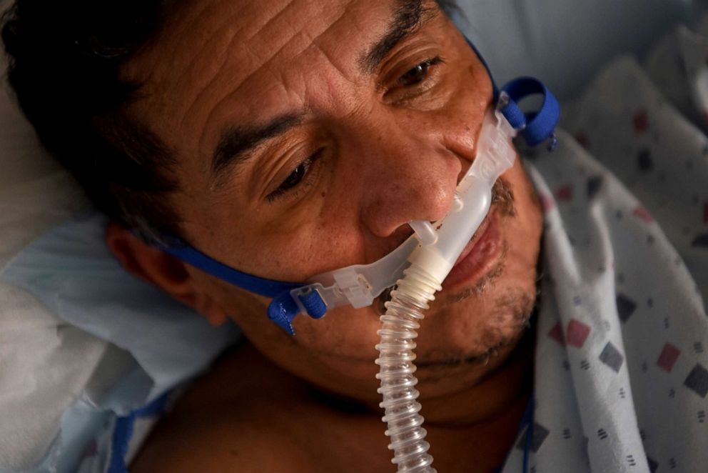 PHOTO: Efrain Guevara, 63, who has been hospitalised after being diagnosed with COVID-19, lies on a hospital bed at United Memorial Medical Center (UMMC), during the coronavirus disease (COVID-19) outbreak, in Houston, Texas, July 17, 2020.