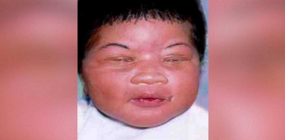 PHOTO: The Jacksonville Sheriff's Office in Florida announced on Jan. 13, 2017, that an 18-year-old woman living in Walterboro, S.C., was identified by authorities as a baby who was kidnapped from a Jacksonville hospital hours after she was born in 1998.