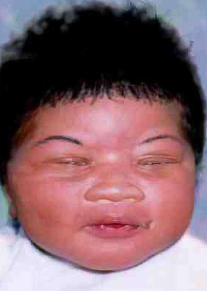 PHOTO: The Jacksonville Sheriffs Office in Florida released this artists depiction of an infant that was taken from a Jacksonville hospital hours after she was born in 1998.