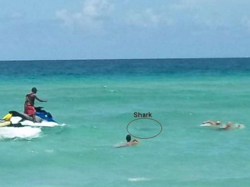 Man survives shark bites to both legs off Florida coast ABC News