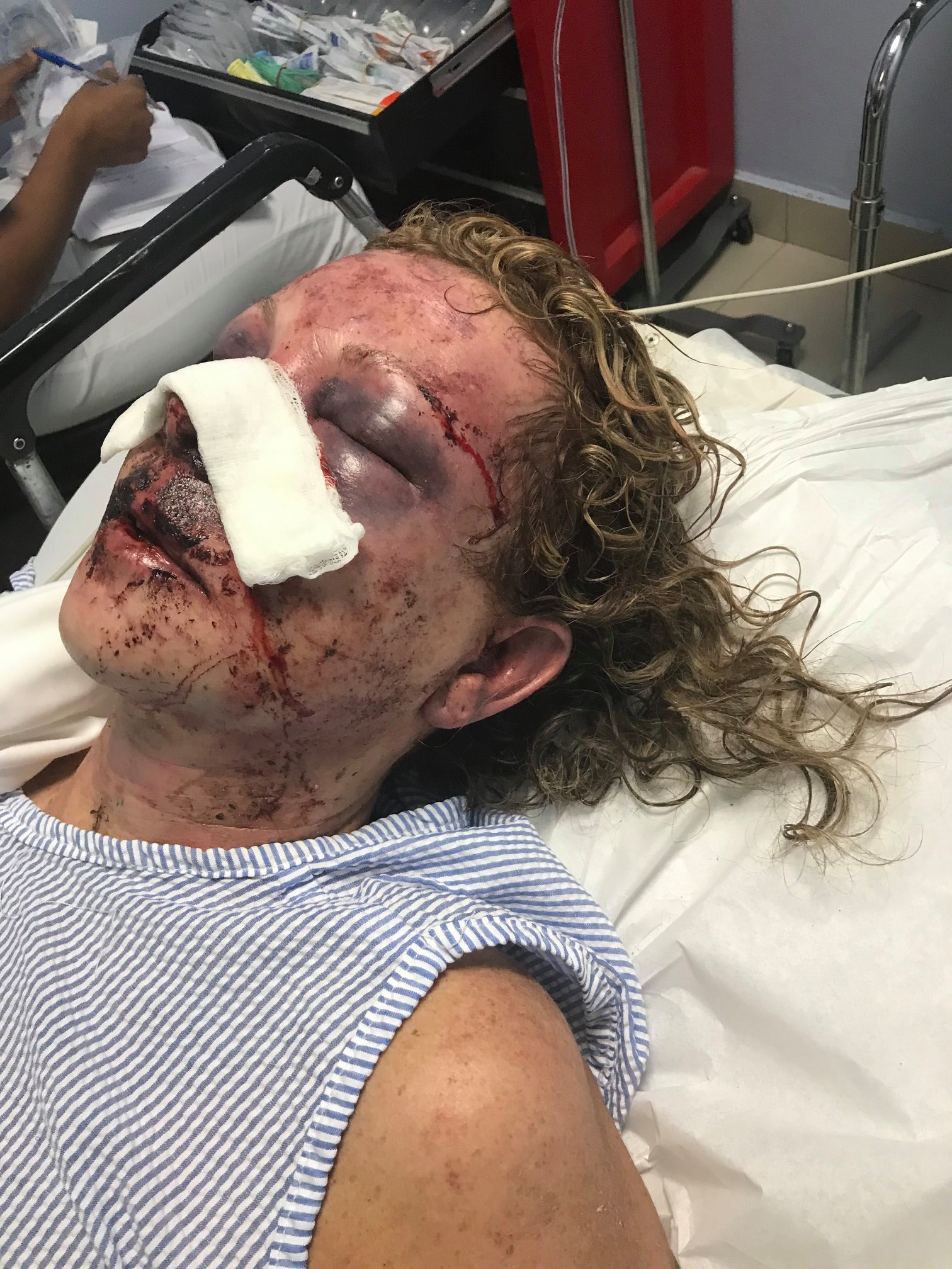 PHOTO: Tammy Lawrence-Daley said she endured a brutal attack while on vacation in the Dominican Republic.