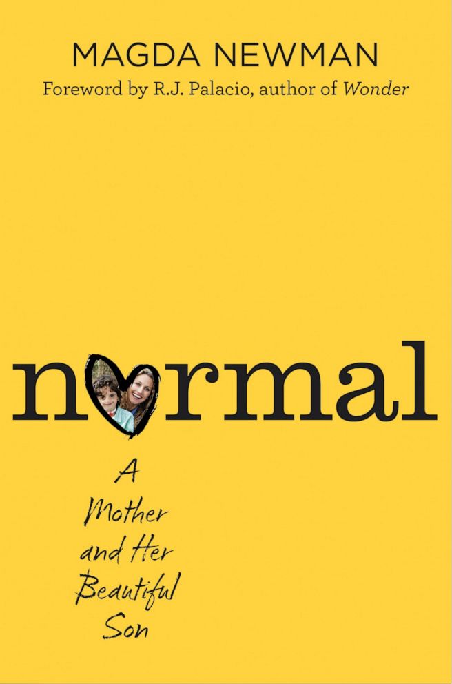 Book cover for "NORMAL: A Mother and Her Beautiful Son"