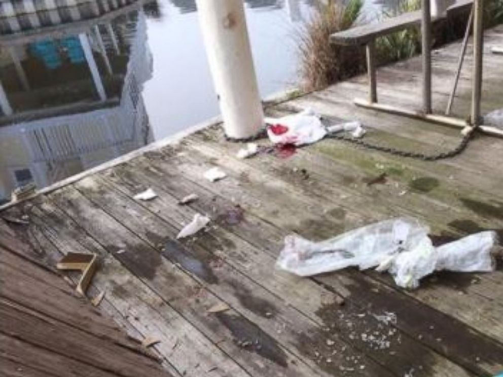 PHOTO: A second-floor wooden balcony collapsed at a condominium in Destin, Florida, on March 1, 2017.