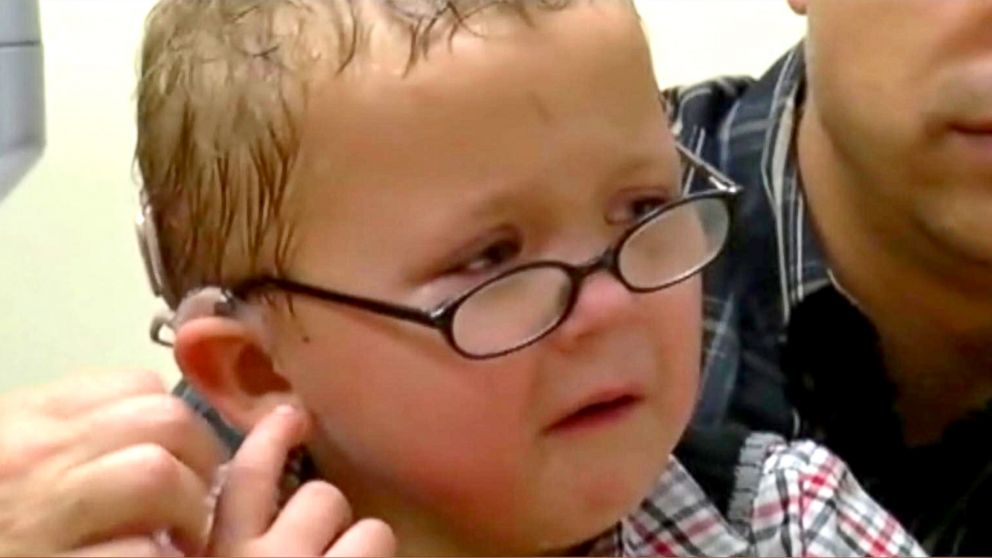 See A 5YearOld Deaf Boy Hear His Mother For The First Time ABC News