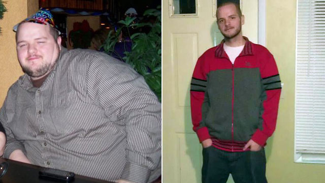 extreme weight loss of 200 pounds photos