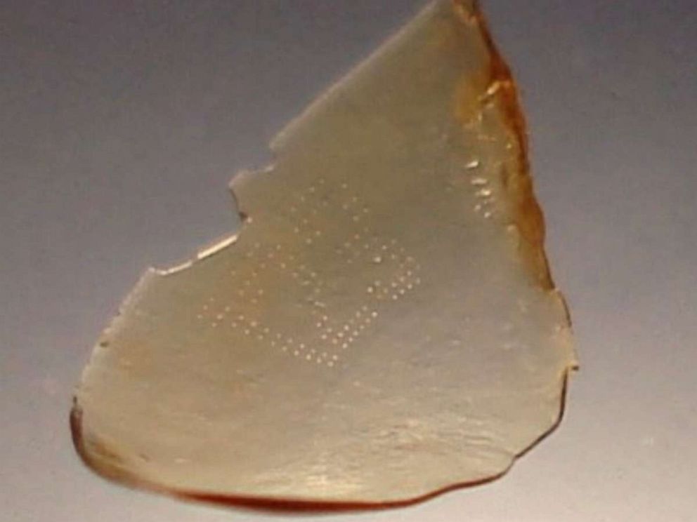 Contact lens that Dr. Charles Zwerling removed from Janet Abaroas eye when he examined her remains.