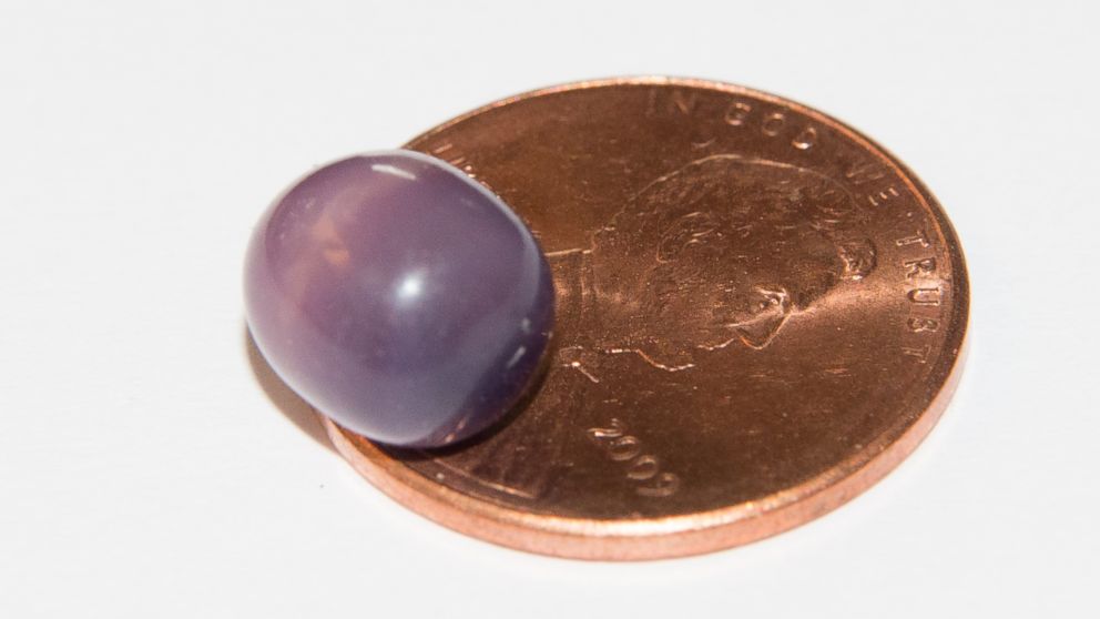 Woman Bites Down On $3,000 Purple Pearl in Clam Shell - ABC News