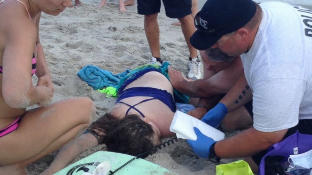 PHOTO: Kiersten Yow is pictured after a shark attacked her.