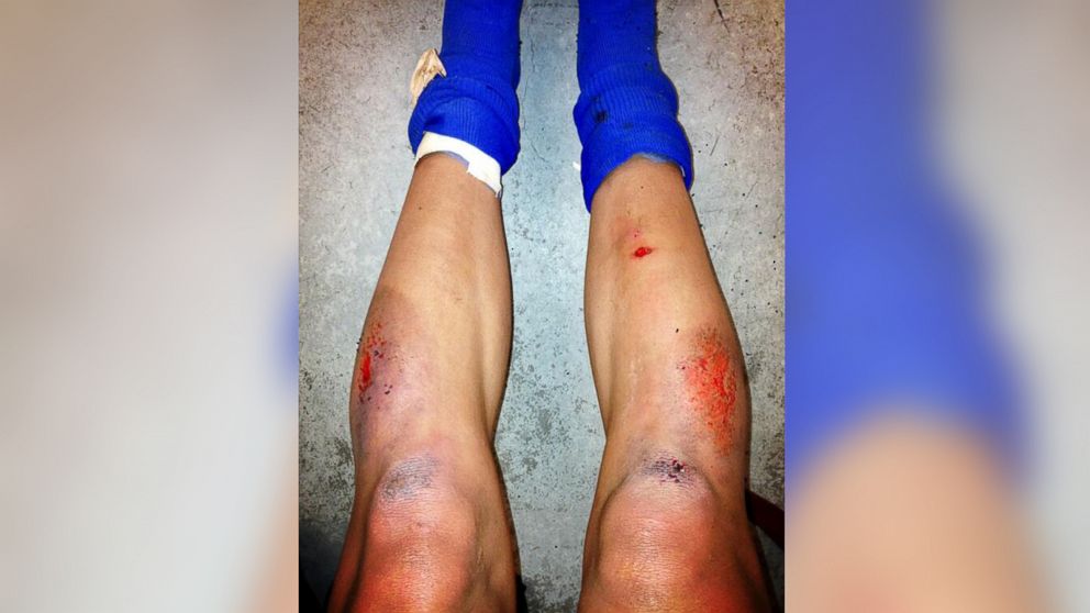 PHOTO: Sydney Leroux of the United States posted this photo to Twitter on April 14, 2013 with the caption, "This is why soccer should be played on grass!"