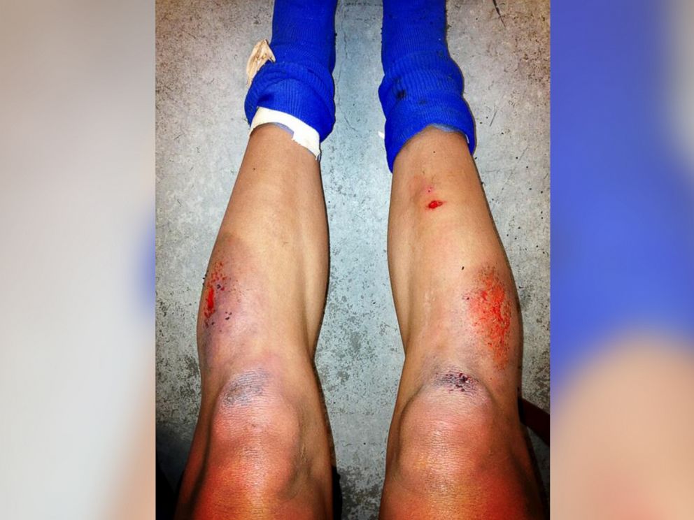 PHOTO: Sydney Leroux of the United States posted this photo to Twitter on April 14, 2013 with the caption, "This is why soccer should be played on grass!"