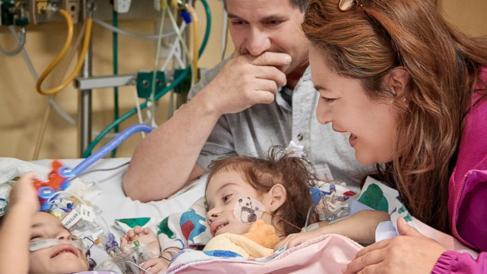 Separated Conjoined Twins Meet For First Time