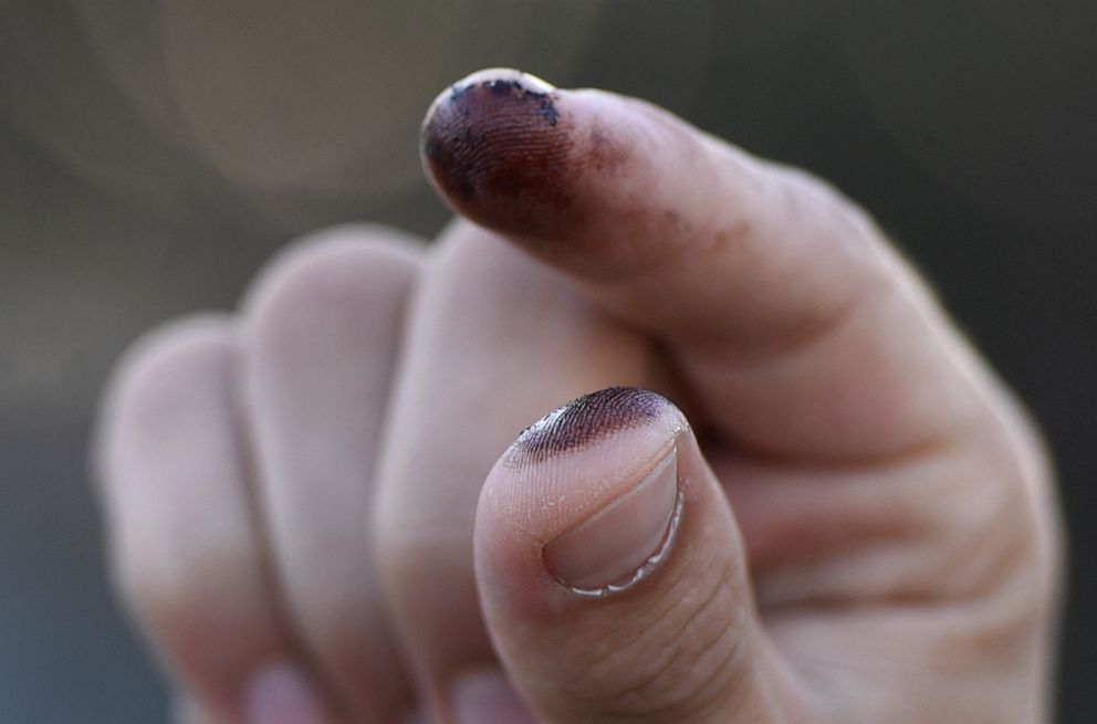PHOTO: A person shows oil on their fingers after touching it on the beach in Huntington Beach, California, Oct. 3, 2021.
