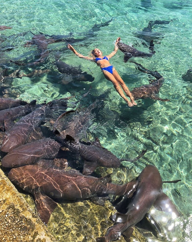 PHOTO: Katarina Zarutskie was bitten on the wrist by a nurse shark in the Bahamas.