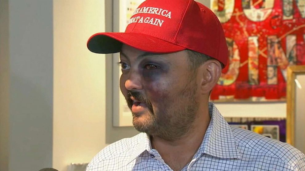 PHOTO: Jahangir Turan said he was attacked by a group of teens in SoHo for wearing the MAGA hat.