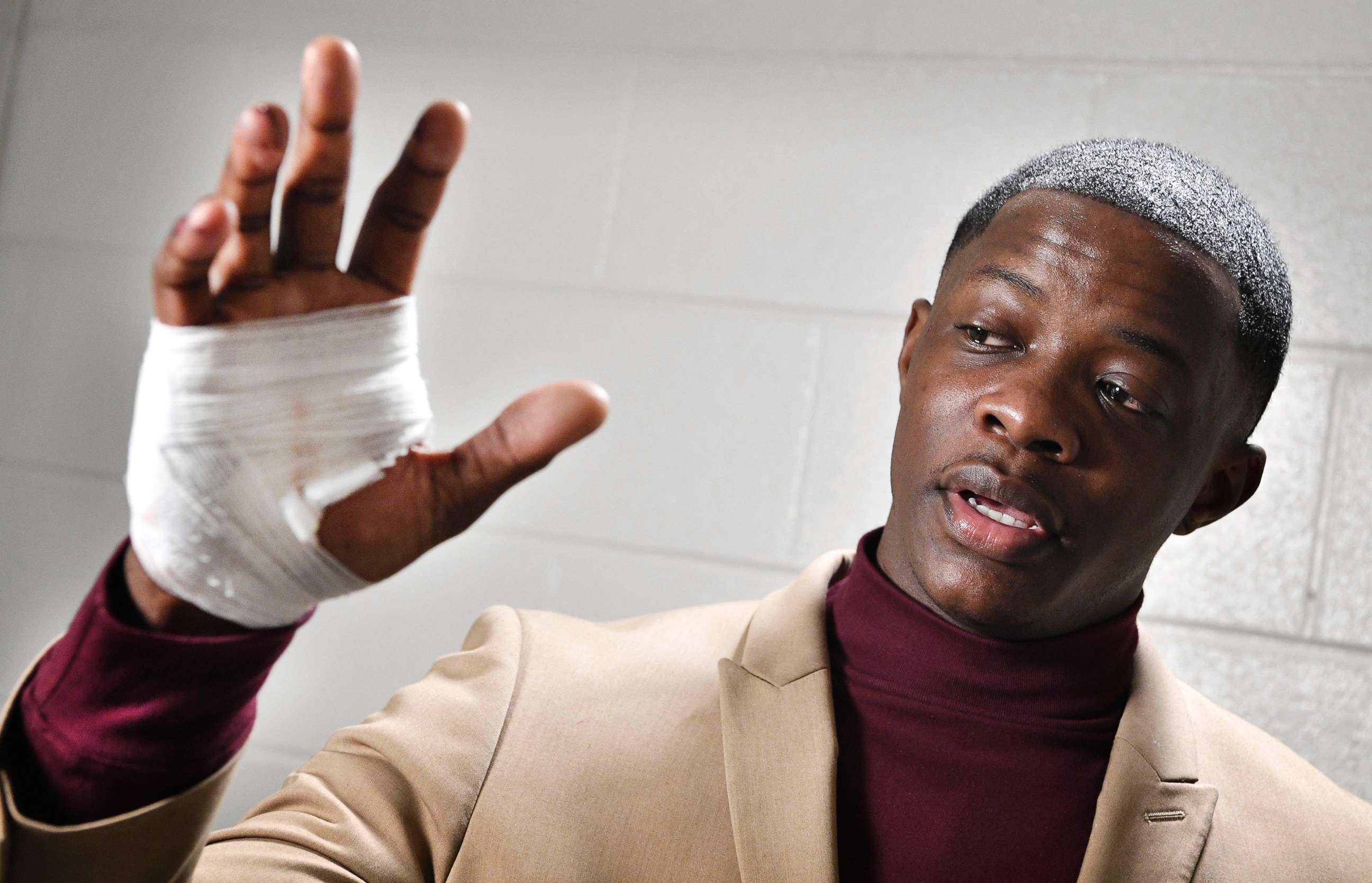 PHOTO: James Shaw Jr., 29, shows his hand that was injured when he disarmed a shooter inside an Antioch Waffle House, April 22, 2018 in Nashville, Tenn.