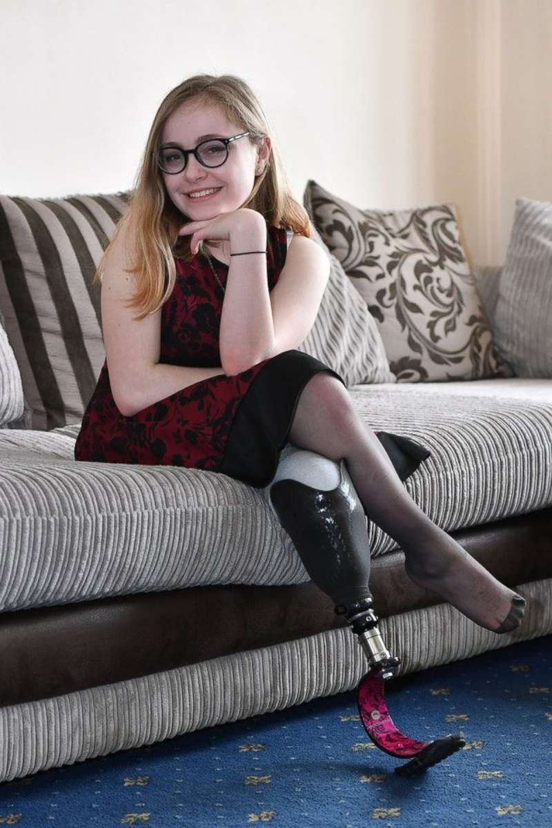 PHOTO: Jorja Furze, 12, is an amputee from birth and ambassador for the Steel Bones charity.